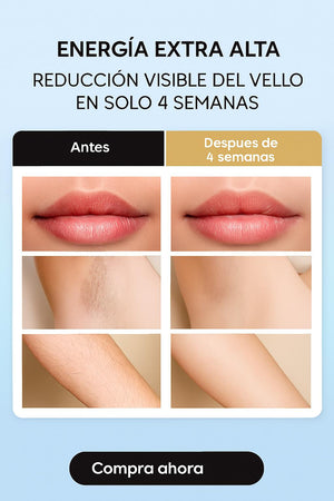 Depiladora Laser IPL
