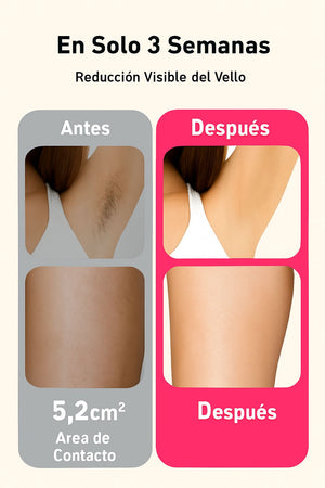 Depiladora IPL